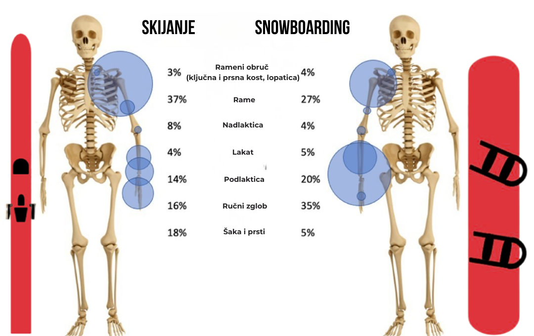 Snowboarding ili skijanje: što je rizičnije?