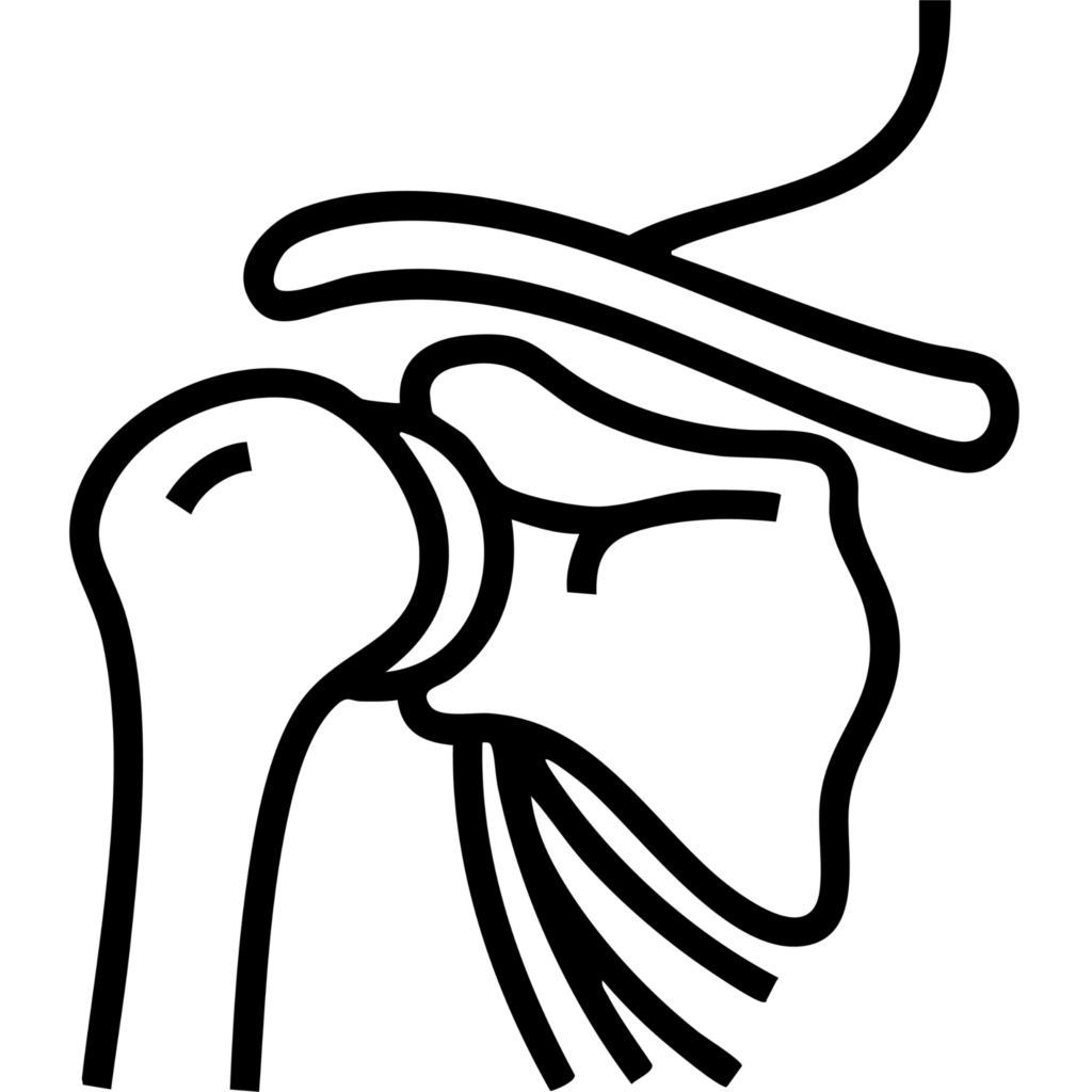 Rehabilitacija 2